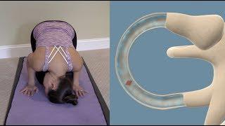 Half Somersault Maneuver to Treat BPPV Vertigo