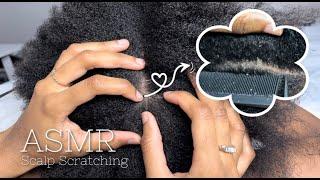 30 MIN ASMR Scalp Scratching‍️ | ULTRA-ZOOMED