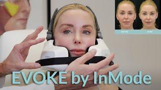 EVOKE by InMode: Saggy Skin Treatment Over 50