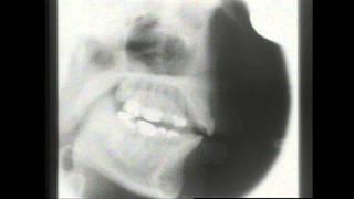 Kevin Munhall Xray Database 4