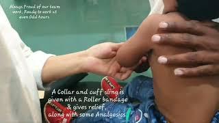 Pulled elbow, reduced | Emrgncy reduction, Pulled elbow | Supersupination method reduction | Adamya