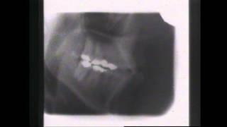 Kevin Munhall Xray Database 1