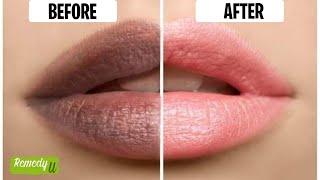 Black Lips vs. Pink Lips | How to Achieve Instant Results