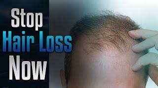 Stop Hair Loss |  Natural hair growth frequency |  hair care | Simply Hypnotic