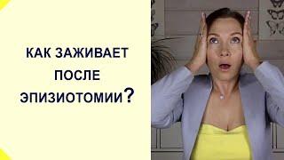 Интимная пластика. Шов после рассечения промежности после родов. Эпизиотомия в родах.