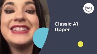 Covering Tooth Gaps | Clip On Veneers | Instasmile Review