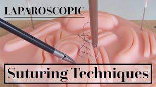 Laparoscopic Suturing Techniques