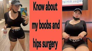 Know about my plastic surgery by Amanda Nicole