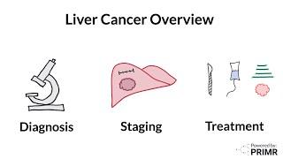 New Liver Cancer Diagnosis - What to Expect