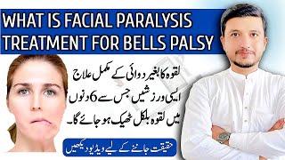 bells palsy | bells palsy treatment | bells palsy exercises | bell's palsy symptoms