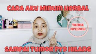 PENGALAMAN PRIBADI !! Herbal Penyembuh Tumor Jinak | Tanty Rahayu