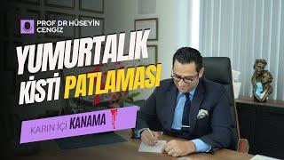  Yumurtalık Kistleri Patlaması ve Karın İçi Kanama: Belirtiler ve Tedavi 🩺