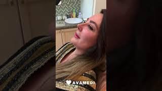 Nasal cast removal after rhinoplasty surgery in Iran 2023 - Avamedi 07