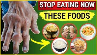 6 Most Dangerous Foods (Don’t Eat If You Have Arthritis)