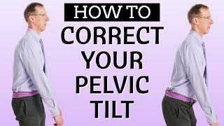 Is An Anterior or Posterior Pelvic Tilt Causing Your Back Pain? How to Tell. How to Correct