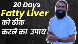 बिना दवाई के फैटी लिवर हीग सही | Yoga for Fatty Liver | Hira Yogi