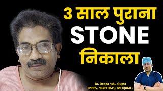 3 साल पुराना Stone निकाला - सच में चमत्कार? | Kidney Stone Laser Treatment #Rirs #patient #laser