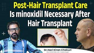 Is Minoxidil Necessary after Hair Transplant || Minoxidil After Hair Transplant || ReDefine Channel