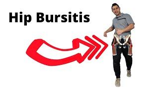 hip bursitis, Trochanteric Bursitis exercise rehabilitation