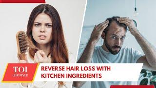 Hair Shedding Like Crazy? Stop the Madness With These Home Remedies