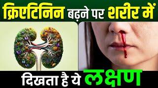 क्रिएटिनिन बढ़ने पर शरीर में दिखता है ये लक्षण | Symptoms of High Creatinine | Karma Ayurveda