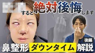 【 ダウンタイム 】 鼻整形 で 後悔 しない為に やること ・ やっちゃダメ なこと ｜ 形成外科 専門医 の 徹底解説 【 後編 】