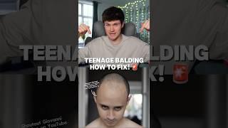 TEENAGE BALDING?! 
