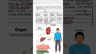 Types of Graft #transplantation #immunology #biology