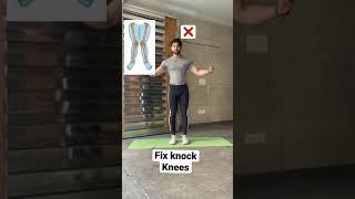 Knock knee Workout | Saurabh Fitness | #youtubeshorts #shorts