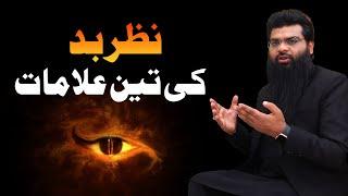 Nazre bad ka ilaj || Powerful Dua Against Bad Evil Eye || Symptoms of Evil Eye || Usman Yazmani