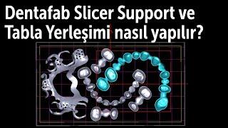 Dentafab Slicer Support ve Tabla Yerleşimi nasıl yapılır?