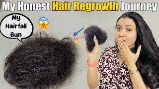 My Hair Loss & Hair Regrowth Journey | Sharing My Story️