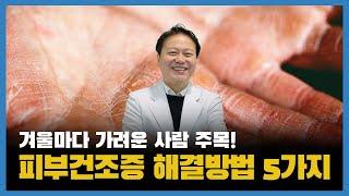 피부건조증 해결방법 5가지 (피부건조)