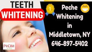 Middletown NY Teeth Whitening with  Peche by Jessica in Middletown Orange County New York  heart