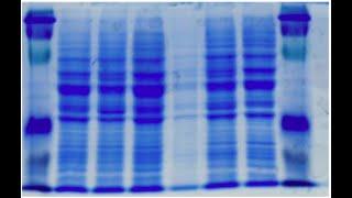 Biochemistry- Module-3: Ionic charge of protein molecule and electrophoresis-3 Sem B.Sc Microbiology