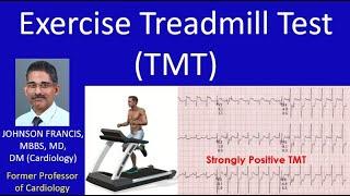 Exercise Treadmill Test TMT