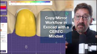 Copy/Mirror in Exocad with a CEREC Mindset