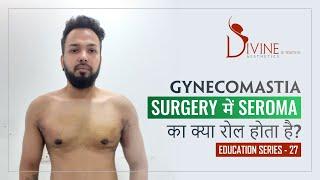 आप जानते है Seroma क्या होता है? | What is Seroma in Gynecomastia? (Education Series - Session 27)