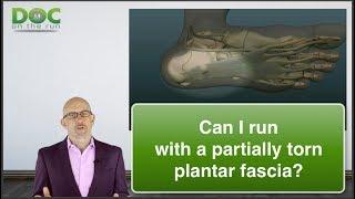 Can I Run with a Partial Rupture of the Plantar Fascia?