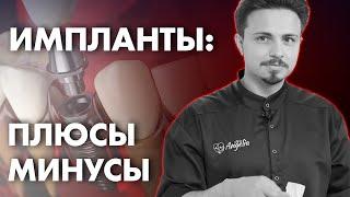 ДЕНТАЛЬНАЯ ИМПЛАНТАЦИЯ | Клиника Online