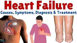 Heart Failure (HF) – Causes, Symptoms, Stages, Diagnosis and Management