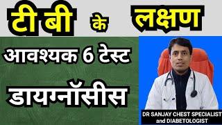 TB ke Lakshan // Symptoms of Tuberculosis // Diagnosis of Tuberculosis // #DrSanjayChestSpecialist