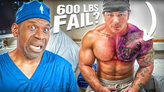 Is Tren Twins Pec Tear A CAREER ENDING Injury? | Surgeon Explains Manic Mike Bench Press Fail