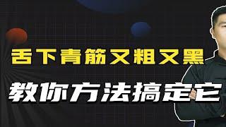 舌头下两条“青筋”又粗又黑，到底是淤血吗？吃三七粉管用吗？