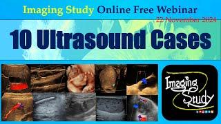 10 Ultrasound Cases || Imaging Study || 22 November 2024 || Online Webinar