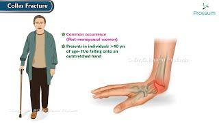 Colles Fracture : Orthopedics Lecture