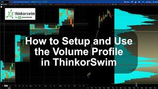  How to Set Up & Use Volume Profile in Thinkorswim: Step-by-Step Tutorial  ThinkorSwim