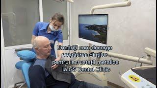 3D SCAN PENTRU CONFECȚIONAREA ÎNCRUSTAȚIEI DENTARE LA GS DENTAL CLINIC #gsdentalclinic, #dental,#3d