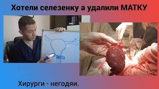 Хотели селезенку а удалили МАТКУ. Хирурги - негодяи.