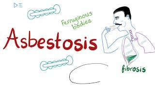 Asbestosis - Mesothelioma - Occupational Lung Disease - Restrictive Lung Disease - Pulmonology